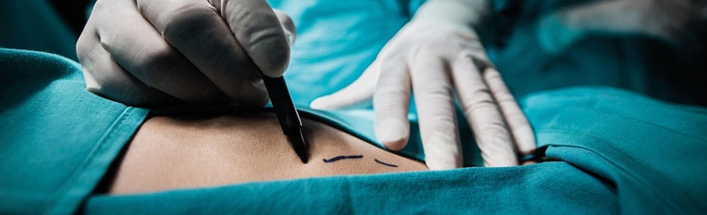 Nip, tuck or fill: 31% of Brits are interested in having cosmetic surgery in the future