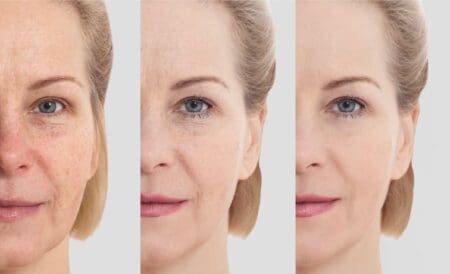 A before and after image of a woman applying facial cream to their face.